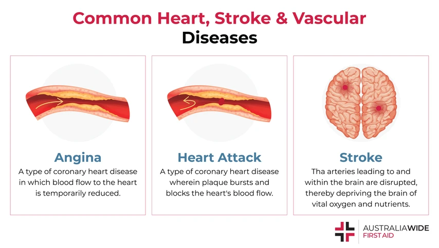 Infographic on Heart, Stroke, and Vascular Diseases